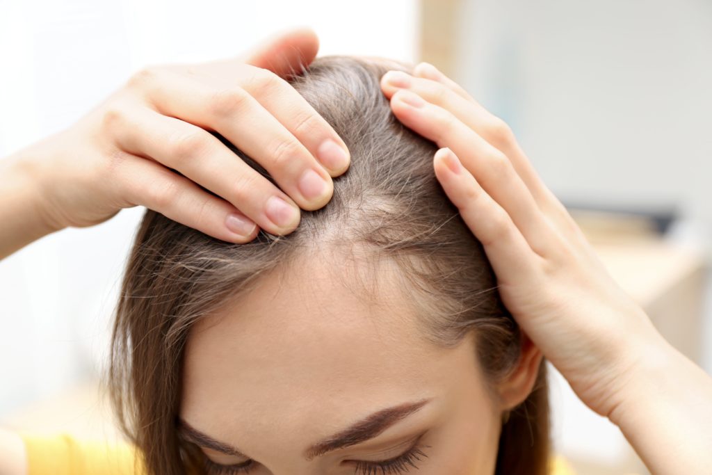 Why is women hair loss different from men